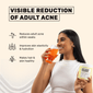 Anti-Acne Collagen