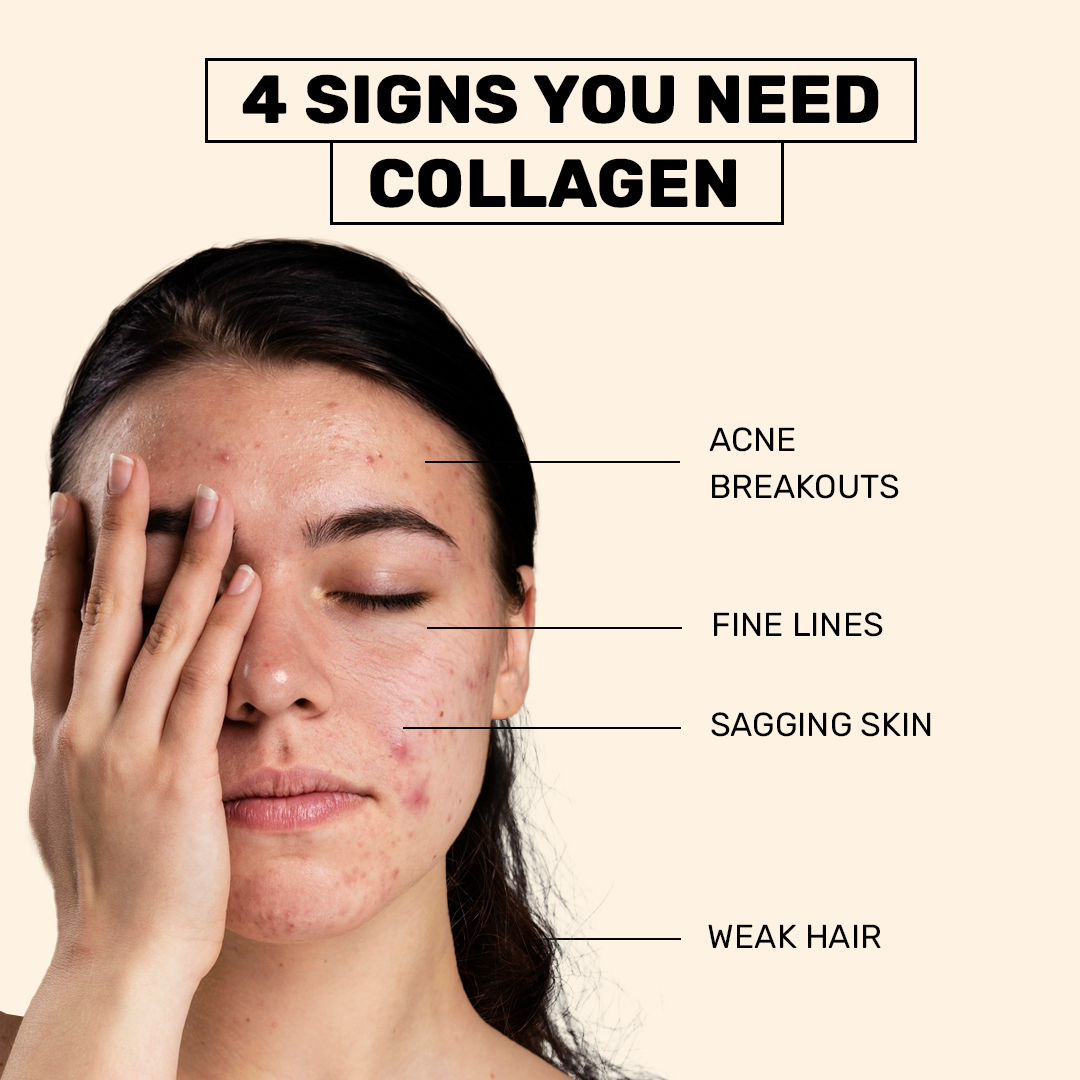 Anti-Acne Collagen