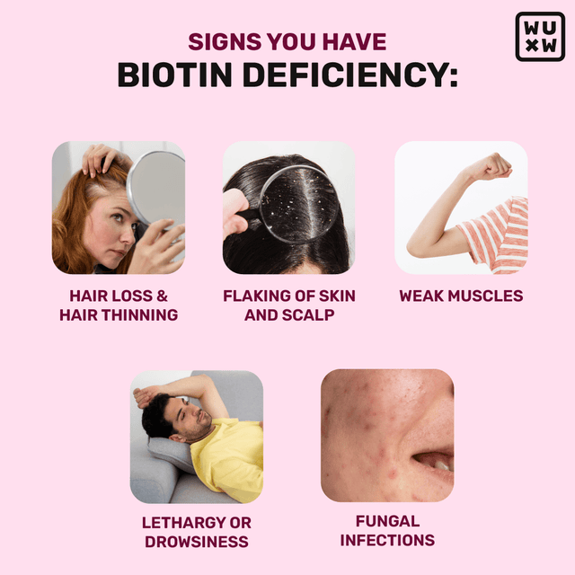 Symptoms Of Biotin Deficiency