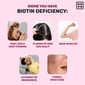 Symptoms Of Biotin Deficiency