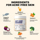 Anti-Acne Collagen